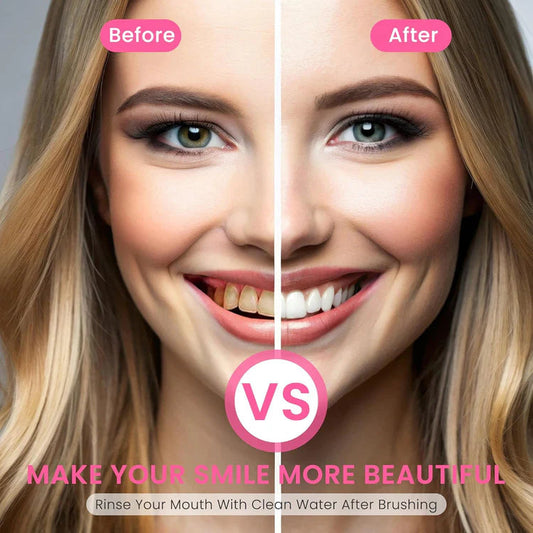 Nicotinamide Whitening Toothpaste 【New Packaging & Powerful Formula Upgrade】